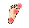 Infant and Children's Foot Assessments 4 Toe Pain treatment | The Heel Centre