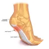 Infant and Children's Foot Assessments 2 Plantar-Fasciitis | The Heel Centre