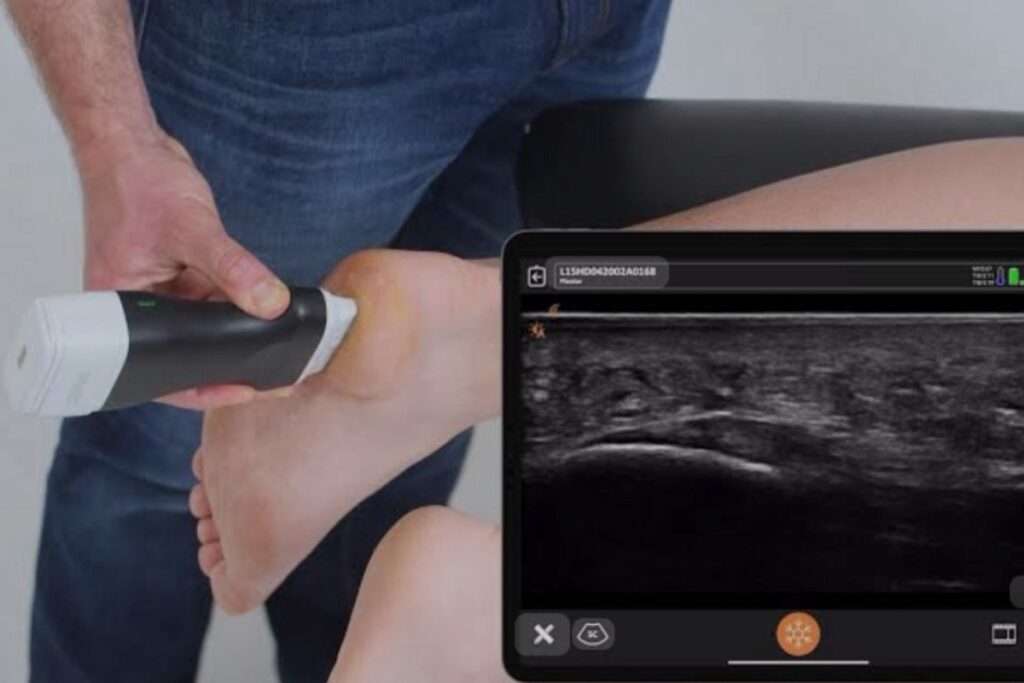 Diagnostic Ultrasound for Heel Pain Relief | The Heel Centre, Melbourne