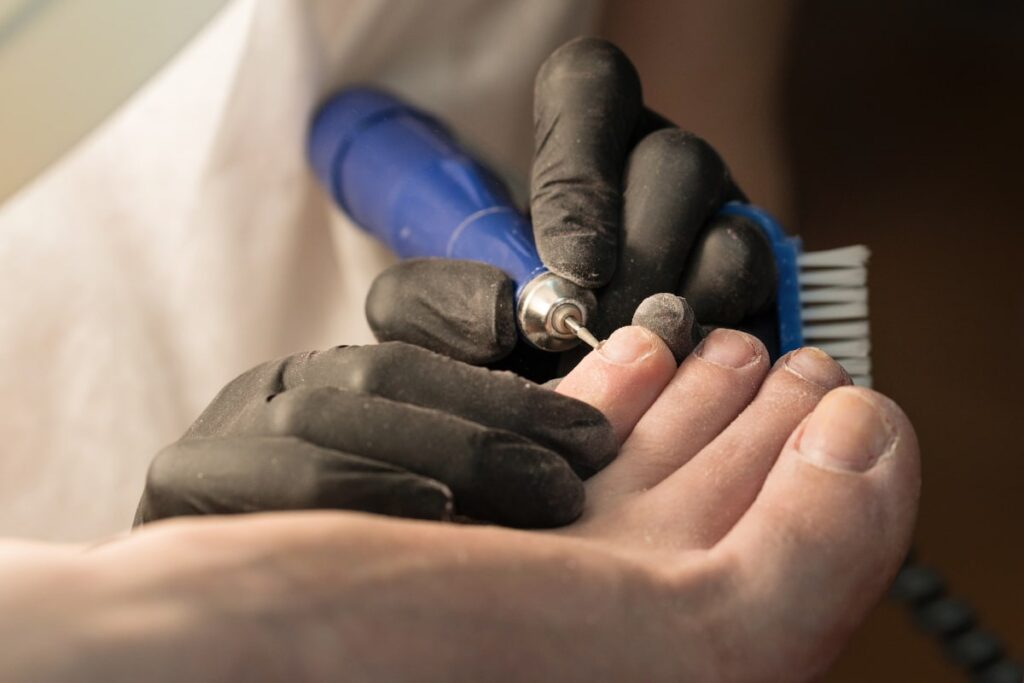 Nail Care and Surgery | The Heel Centre