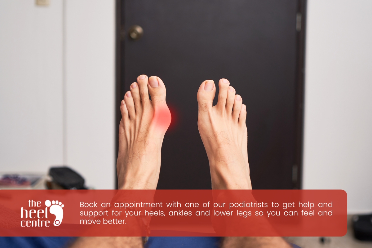 Bunion Pain Relief | The Heel Centre Ringwood East