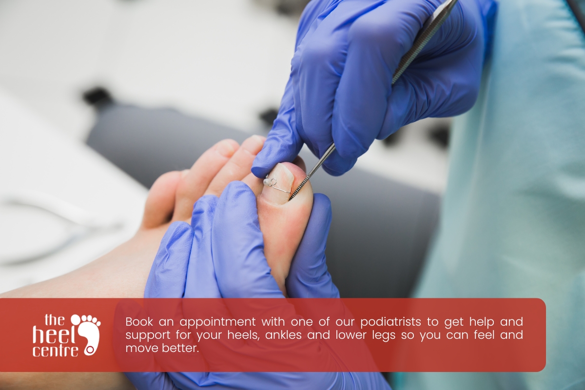 Ingrown Toenails: Prevention, Home Remedies, And When To Seek Professional Help 2 Ingrown Toenails Prevention Home Remedies | The Heel Centre Frankston